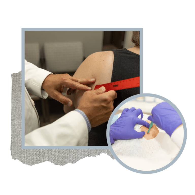 Expert Skin Cancer Treatment in Little Rock, Arkansas - Franks Dermatology